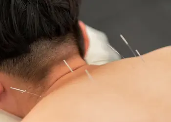 Acupuncture