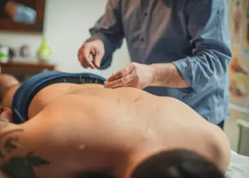 Cupping Therapy Benefits