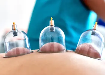 Hijama Home Service