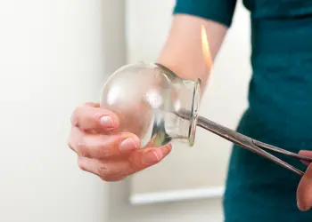 Fire Cupping Treatment