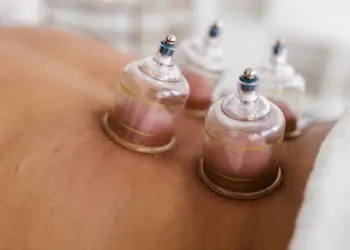 Wet Cupping Therapy